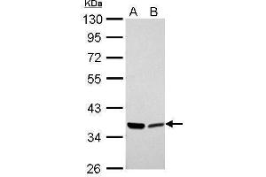 WB Image Annexin II antibody detects ANXA2 protein by Western blot analysis.