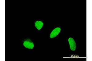 Immunofluorescence of monoclonal antibody to KLHDC4 on HeLa cell. (KLHDC4 anticorps  (AA 1-463))