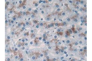 Detection of TP53TG5 in Human Liver Tissue using Polyclonal Antibody to TP53 Target Gene 5 (TP53TG5)
