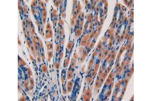 Used in DAB staining on fromalin fixed paraffin- embedded stomach tissue (CYP24A1 anticorps  (AA 260-514))