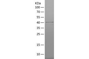 Western Blotting (WB) image for Organic Anion Transporter H (OATP-H) (AA 1-101) protein (His-IF2DI Tag) (ABIN7124268)
