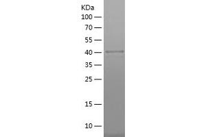 Western Blotting (WB) image for Organic Anion Transporter H (OATP-H) (AA 1-101) protein (His-IF2DI Tag) (ABIN7124268) (SLCO4C1 Protein (AA 1-101) (His-IF2DI Tag))