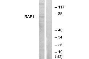Western blot analysis of extracts from HT-29 cells, using Raf1 (Ab-341) antibody. (RAF1 anticorps  (Tyr341))