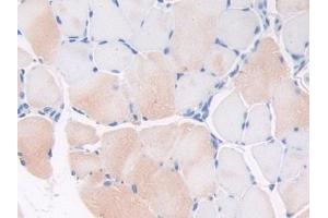 Detection of THBS1 in Mouse Skeletal muscle Tissue using Polyclonal Antibody to Thrombospondin 1 (THBS1)