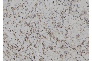 ABIN6272929 at 1/100 staining Human gastric tissue by IHC-P. (SKAP2 anticorps  (C-Term))