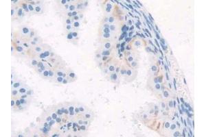 IHC-P analysis of Mouse Oviduct Tissue, with DAB staining.