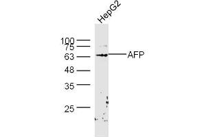 HepG2 lysates probed with AFP Polyclonal Antibody, Unconjugated  at 1:300 dilution and 4˚C overnight incubation. (alpha Fetoprotein anticorps  (AA 501-609))