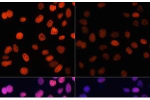 Immunofluorescence analysis of HeLa cells using Acetyl-Histone H4-K91 Polyclonal Antibody at dilution of 1:100. (Histone H4 anticorps  (acLys91))