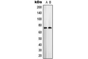 Western blot analysis of ARALAR1 expression in COLO205 (A), U251MG (B) whole cell lysates. (SLC25A12 anticorps  (Center))