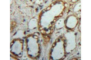 IHC-P analysis of kidney tissue, with DAB staining. (C1QBP anticorps  (AA 72-279))