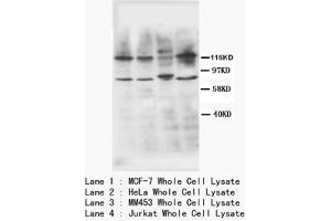 Western blot with TNFR2 Polyclonal Antibody (TNFRSF1B anticorps  (N-Term))