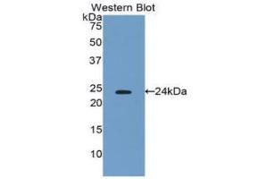 Western Blotting (WB) image for anti-Interferon, beta 1, Fibroblast (IFNB1) (AA 22-186) antibody (ABIN3209030) (IFNB1 anticorps  (AA 22-186))