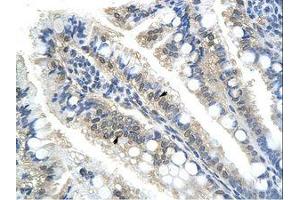 Image no. 2 for anti-Nucleus Accumbens Associated 1, BEN and BTB (POZ) Domain Containing (NACC1) (C-Term) antibody (ABIN202717)