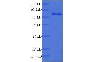 SDS-PAGE (SDS) image for CD3 epsilon (CD3E) (AA 23-207) protein (GST tag) (ABIN5712734)