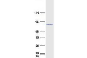 Validation with Western Blot