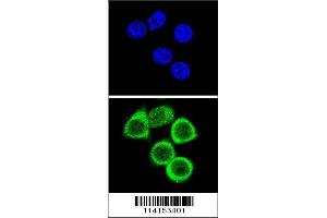 Confocal immunofluorescent analysis of PARP1 Antibody with Hela cell followed by Alexa Fluor 488-conjugated goat anti-rabbit lgG (green).
