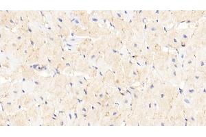 Detection of RAGE in Human Cardiac Muscle Tissue using Polyclonal Antibody to Receptor For Advanced Glycation Endproducts (RAGE)