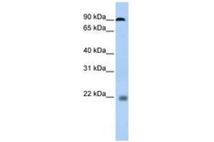 Image no. 1 for anti-Nuclear Factor of Activated T-Cells, Cytoplasmic, Calcineurin-Dependent 1 (NFATC1) (N-Term) antibody (ABIN6742798) (NFATC1 anticorps  (N-Term))