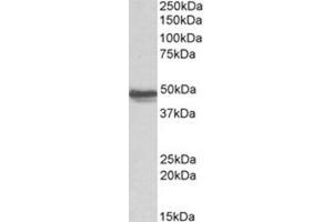 Image no. 1 for anti-Glial Fibrillary Acidic Protein (GFAP) (C-Term) antibody (ABIN374749) (GFAP anticorps  (C-Term))