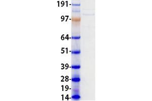 Validation with Western Blot
