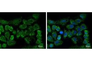 ICC/IF Image CLPP antibody [C2C3], C-term detects CLPP protein at mitochondria by immunofluorescent analysis.