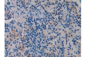 Used in DAB staining on fromalin fixed paraffin- embedded adrenal gland tissue (ADAMTS1 anticorps  (AA 854-967))