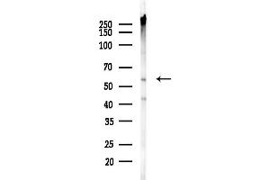 Western blot analysis of lysates from COLO205 cells(heat-shock,45 min treatment), using GLU Antibody at 1/1000 dilution.