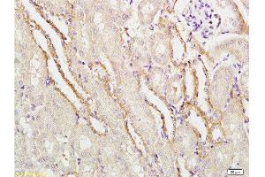 Formalin-fixed and paraffin embedded mouse kidney labeled with Rabbit Anti-APG5L/ATG5 Polyclonal Antibody  at 1:100 followed by conjugation to the secondary antibody and DAB staining. (ATG5 anticorps  (AA 101-200))