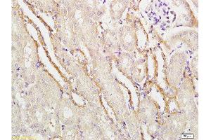 Formalin-fixed and paraffin embedded mouse kidney labeled with Rabbit Anti-APG5L/ATG5 Polyclonal Antibody  at 1:100 followed by conjugation to the secondary antibody and DAB staining. (ATG5 anticorps  (AA 101-200))