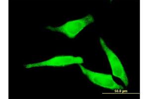 Immunofluorescence of monoclonal antibody to NT5C2 on HeLa cell.