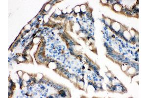 Anti- Plectin Picoband antibody, IHC(P) IHC(P): Rat Intestine Tissue