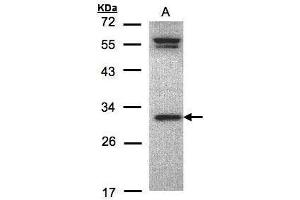 WB Image Sample(30 ug whole cell lysate) A:MOLT4 , 12% SDS PAGE antibody diluted at 1:1000 (ORC6 anticorps  (C-Term))