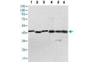 Western blot analysis using PDK1 monoclonal antobody, clone 4A11  against NIH/3T3 (1), HeLa (2), Jurkat (3), HepG2 (4), PC-12 (5), and COS-7 (6) cell lysate.