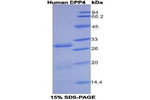 SDS-PAGE (SDS) image for Dipeptidyl-Peptidase 4 (DPP4) protein (His tag) (ABIN1099045)