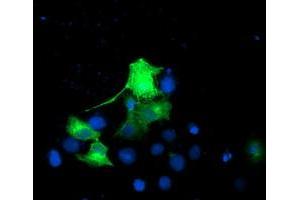 Anti-EPN2 mouse monoclonal antibody (ABIN2455557) immunofluorescent staining of COS7 cells transiently transfected by pCMV6-ENTRY EPN2 (RC213652). (Epsin 2 anticorps)