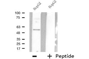 Western blot analysis of extracts from HepG2 cells using AGXT2L2 antibody. (AGXT2L2 anticorps  (C-Term))