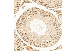 Immunohistochemistry of paraffin embedded rat testis using DNApoldelta3 (ABIN7075130) at dilution of 1:1000 (300x lens) (POLD3 anticorps)