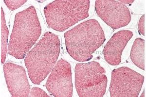 Rabbit Anti-NRF1 antibody  Formalin Fixed Paraffin Embedded Tissue: Human Adult Skeletal muscle  Observed Staining: Cytoplasm in hepatocytes Primary Antibody Concentration: 1:600 Secondary Antibody: Donkey anti-Rabbit-Cy3 Secondary Antibody Concentration: 1:200 Magnification: 20X Exposure Time: 0.