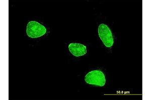 Immunofluorescence of monoclonal antibody to MEF2BNB on HeLa cell . (MEF2BNB anticorps  (AA 1-109))