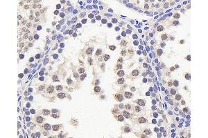 Immunohistochemistry analysis of paraffin-embedded rat testis using HES2 Polyclonal Antibody at dilution of 1:200.