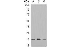 Western blot analysis of Telethonin expression in mouse heart (A), rat heart (B), rat skeletal muscle (C) whole cell lysates. (TCAP anticorps)