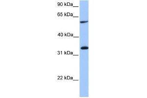 TSKS antibody used at 1 ug/ml to detect target protein. (TSKS anticorps  (Middle Region))