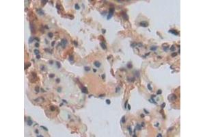 Used in DAB staining on fromalin fixed paraffin- embedded lung tissue (DDC anticorps  (AA 200-420))