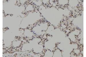 ABIN6269204 at 1/100 staining Rat lung tissue by IHC-P. (SHP1 anticorps  (C-Term))