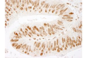 Immunohistochemistry (IHC) image for anti-Zinc Finger Protein 326 (ZNF326) (AA 532-582) antibody (ABIN7449042) (ZNF326 anticorps  (AA 532-582))