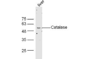 Mouse liver lysates probed with Rabbit Anti-Catalase Polyclonal Antibody, Unconjugated  at 1:500 for 90 min at 37˚C. (Catalase anticorps  (AA 251-350))