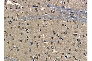 ABIN6263498 and ABIN6268752 at 1/100 staining rat brain tissue by IHC-P.