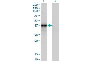 Western Blot analysis of NOV expression in transfected 293T cell line by NOV monoclonal antibody (M01), clone 3C2.