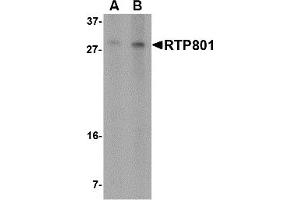 Western Blotting (WB) image for anti-DNA-Damage-Inducible Transcript 4 (DDIT4) (N-Term) antibody (ABIN1031547) (DDIT4 anticorps  (N-Term))