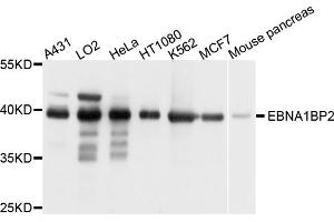 Western blot analysis of extracts of various cell lines, using EBNA1BP2 antibody. (EBNA1BP2 anticorps)